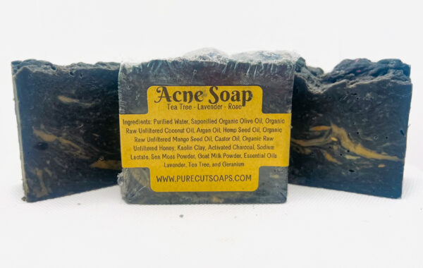 Acne Soap