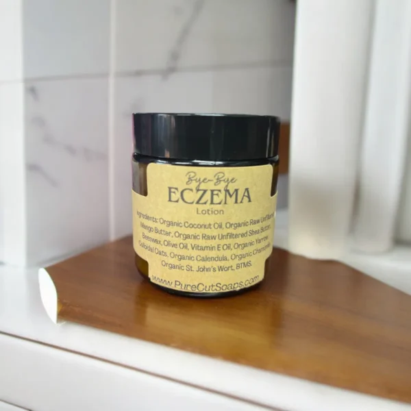 Bye-Bye Eczema Lotion - Image 7